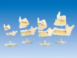 ZM1054牙齒發育模型（新生兒、5歲、9歲、20歲階段）