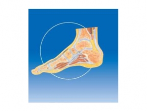 ZM1036-2 踝關節剖面模型