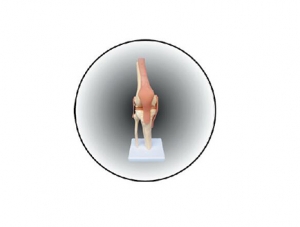 ZM1030 膝關節模型
