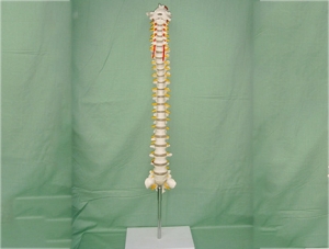 ZM1023-7 彎曲脊椎模型