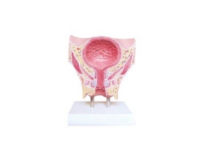 ZM1092 女性盆部經膀胱冠狀切模型