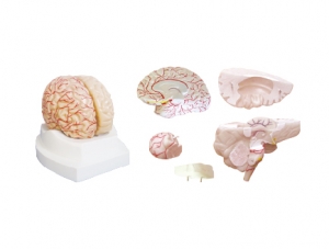 ZM1162 腦外形及右半側腦血管