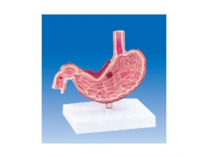 ZM2009  病態胃解剖模型