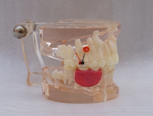 ZM-A16-02_C8乳牙早失病態模型