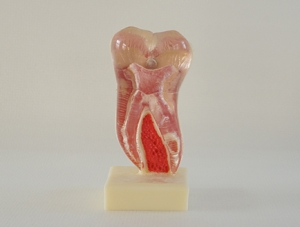 ZM-DSC01835__C21六倍下頜磨牙剖面