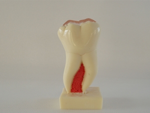 ZM-DSC01836_C21六倍下頜磨牙剖面