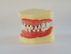 ZM-DSC01951_L4牙周病模型