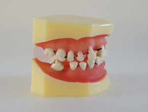 ZM-DSC01952_L4牙周病模型