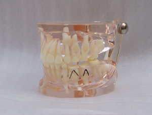 ZM-A16-01_C8乳牙早失病態模型